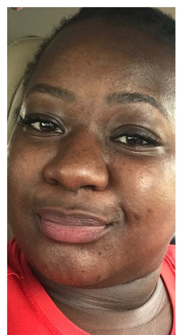 Monica, 38 before using Magic Serum