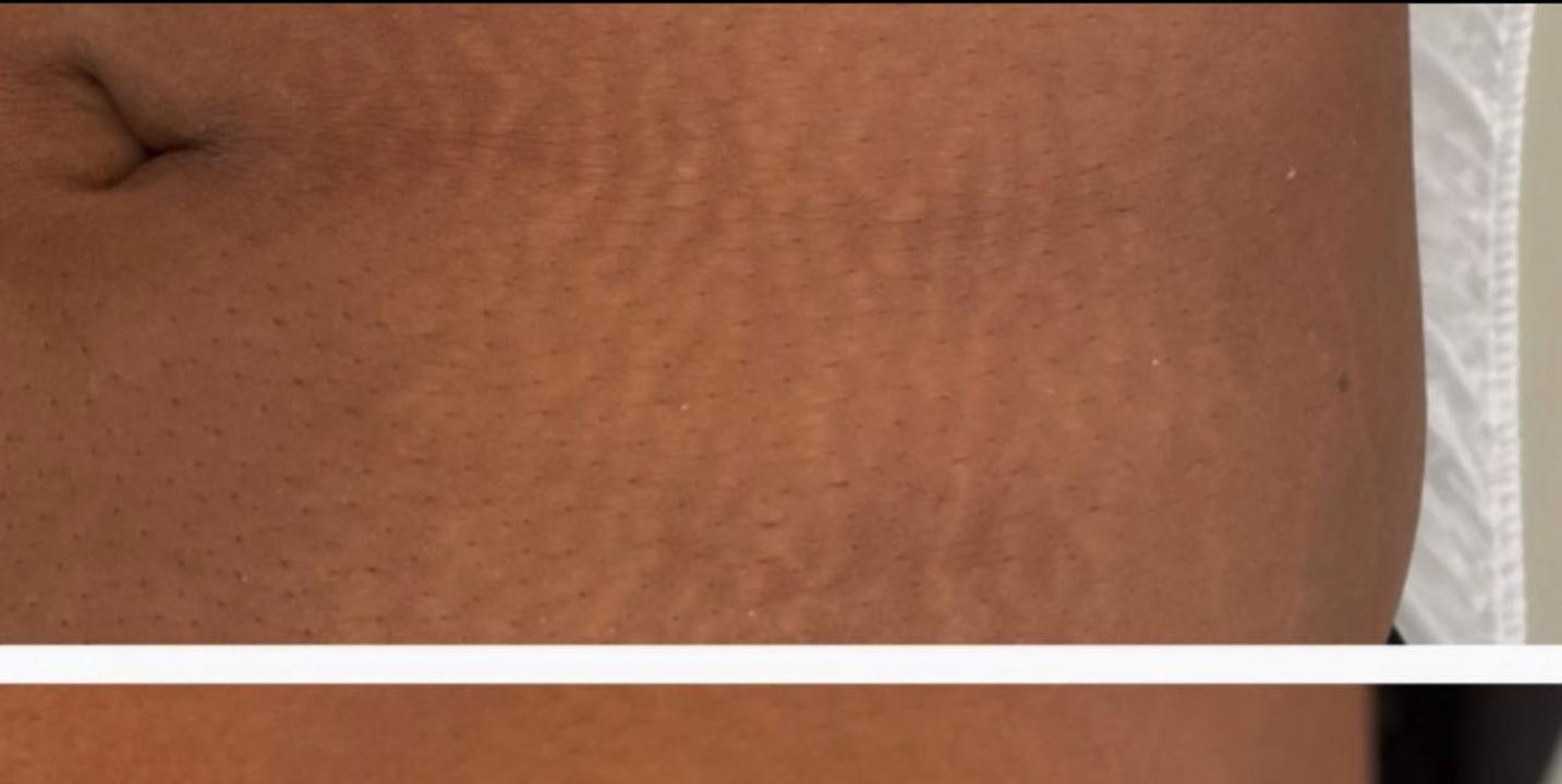 Jasmine, 32 before using Magic Serum + Body Butter
